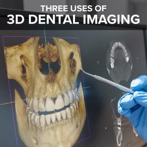 Carson City dentists, Dr. Euse & Dr. Wright at Advanced Dentistry by Design discuss how using 3D Dental Imaging helps improve patient care and treatment outcomes. Read on to understand the wide range of applications of 3D Dental imaging.