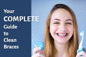 Everything You Need to Know About Custom Braces