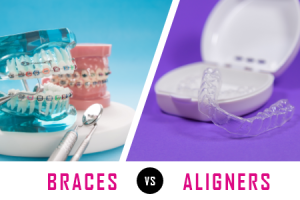 Carson City dentists, Drs. Euse & Wright of Advanced Dentistry by Design talks about what factors need to be considered when deciding between getting braces or clear aligners for corrections.