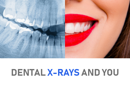 Advanced Dentistry by Design in Carson City explains the different types of x-rays used in dental practices.