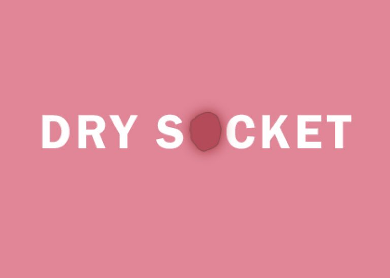 will dry socket heal on its own will dry socket heal on its own