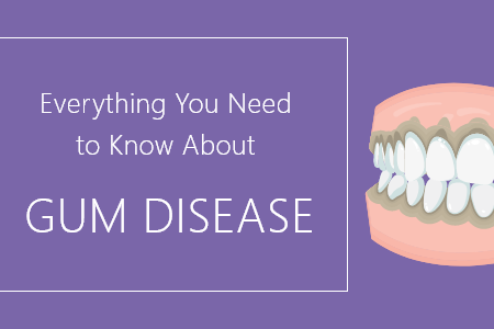 Advanced Dentistry by Design tell you everything you wanted to know about Gum Disease