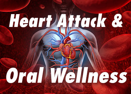 Carson City dentists, Dr. Clint Euse, Dr. Kelly Euse, Dr. Randy Wright, and Dr. Matt Lisenby at Advanced Dentistry by Design explain the connection between poor oral hygiene and heart attacks.