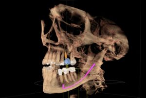 Galileos CBCT Scanner