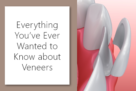 Carson City Dentists Dr. Clint Euse, Dr. Kelly Euse, Dr. Randy Wright, and Dr. Matt Lisenby of Advanced Dentistry by Design let you know everything about Veneers