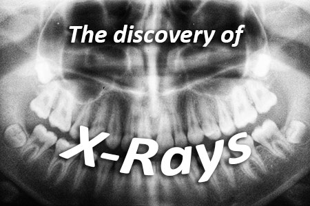 Carson City dentists at Advanced Dentistry by Design discusses the discovery of x-rays and how they have advanced over the years.