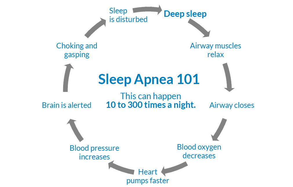 Sleep Apnea Sleep Cycle